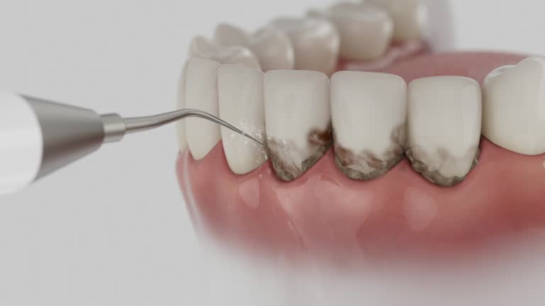 Trusted Root Canal Treatment service in North Kingsville, OH - Dentist Open Now